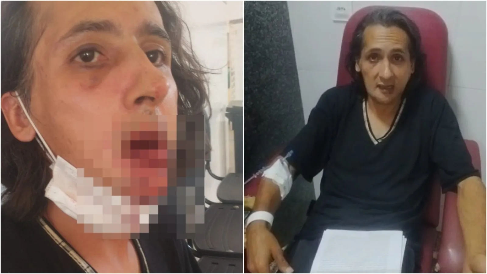 Agricultor fica com lesões permanentes após agressão em Itapipoca