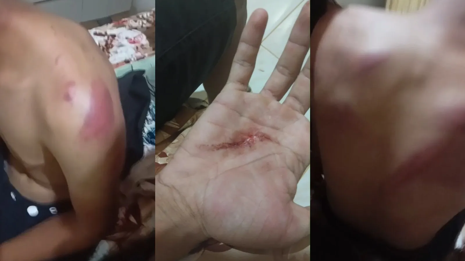 Família denuncia policiais militares por tortura contra jovem