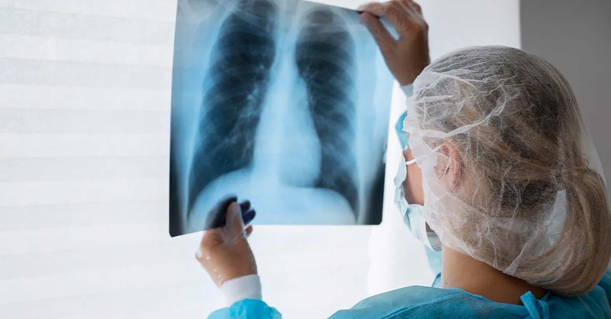 Inca alerta: Fumar e treinar não combinam