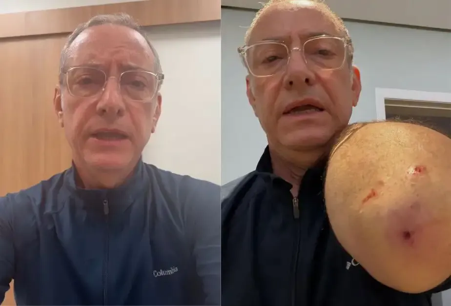 Jornalista José Roberto Burnier é atacado por pitbull em São Paulo