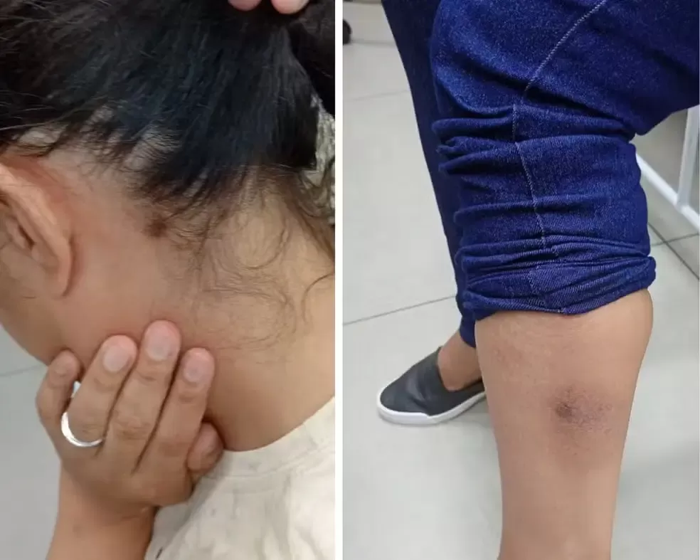 Mãe e filho resgatados após viverem anos em cárcere privado no interior de SP