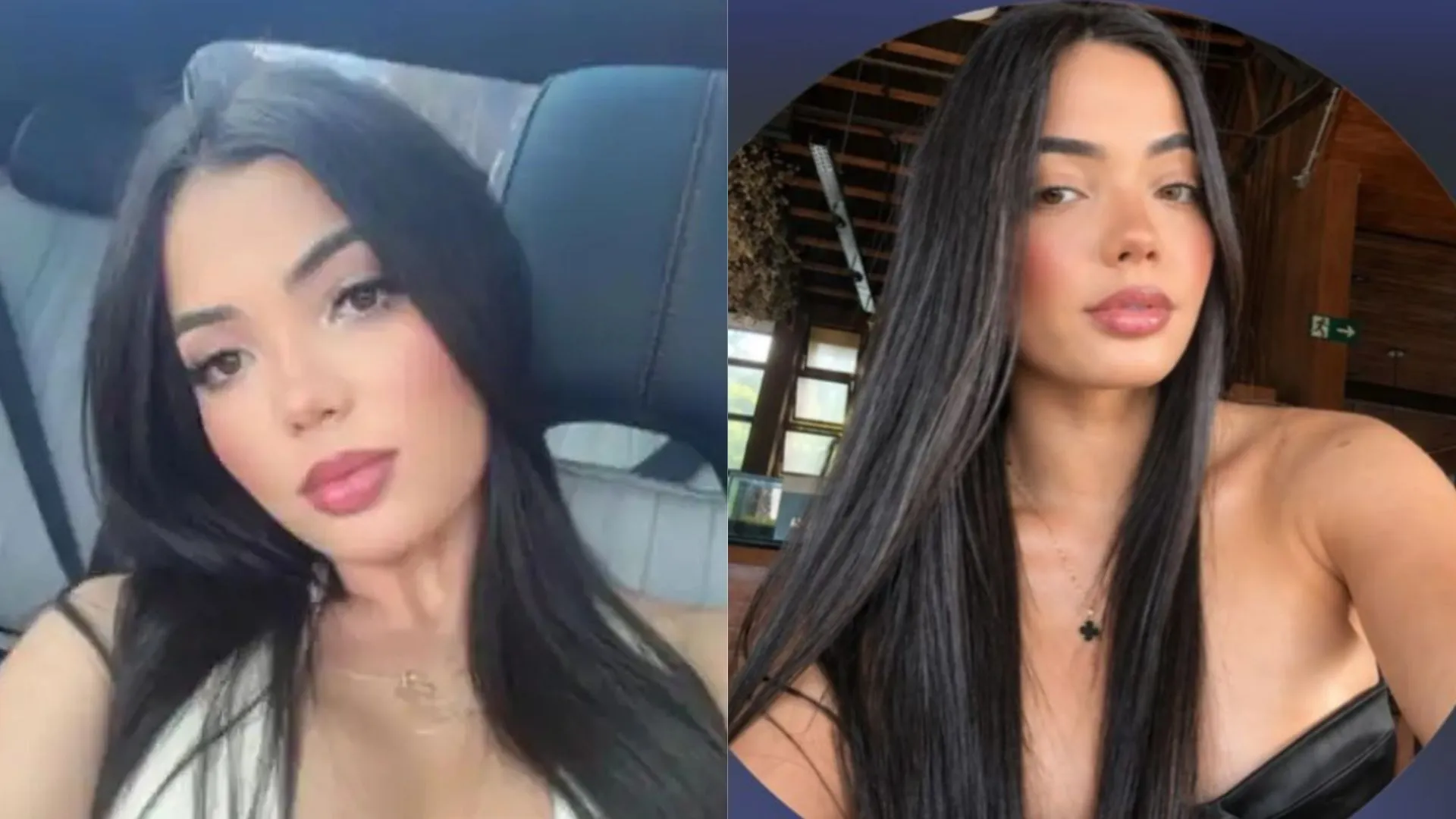 Mulher de 27 anos morre durante procedimento estético em BH