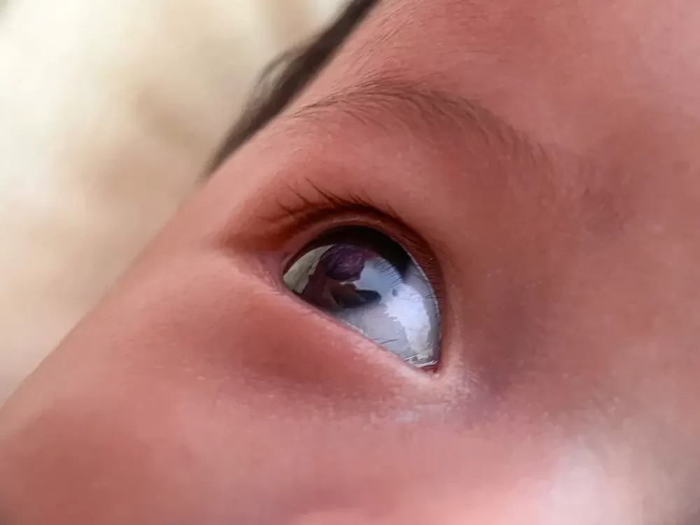 Oportunidade em Fortaleza: Exames de Visão Gratuitos para Crianças e Adultos