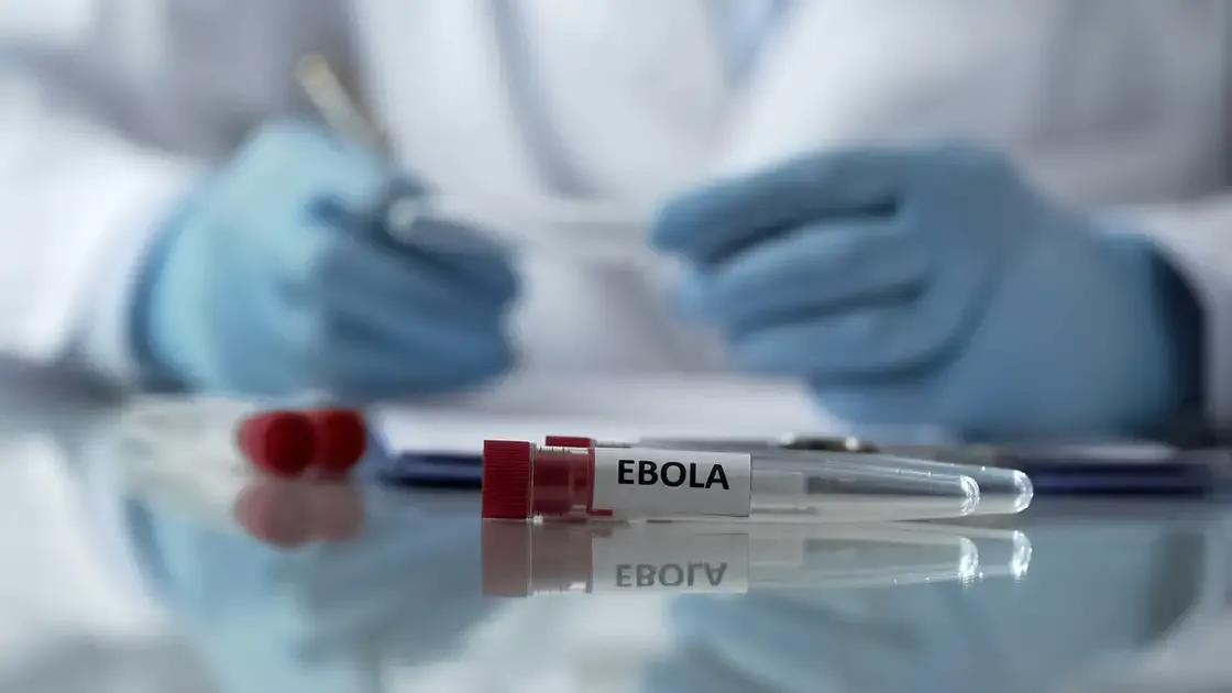 São Paulo registra caso suspeito de Ebola