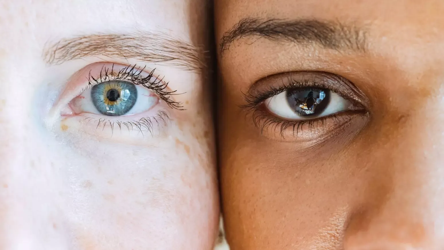Sinais nos Olhos Podem Indicar Desenvolvimento de Demência Anos Antes do Diagnóstico
