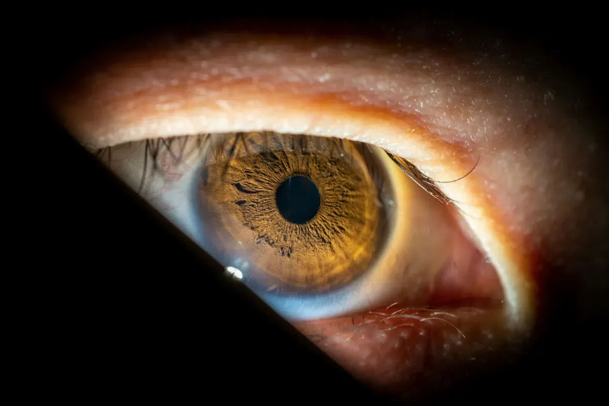 SUS passa a oferecer cirurgia combinada para catarata e glaucoma